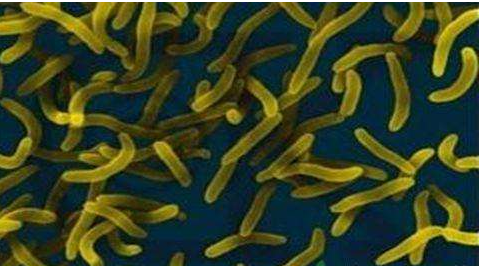 微生物菌劑好？好在哪里您知道嗎？